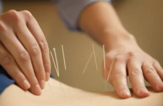 Pros And Cons Of Dry Needling